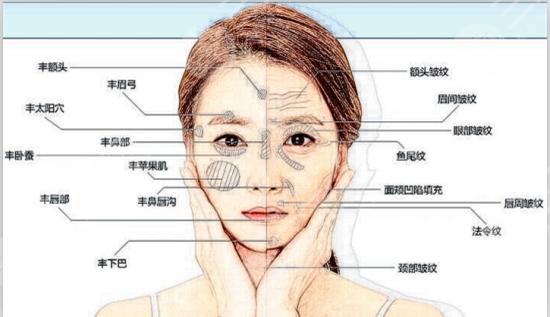 自体脂肪填充泪沟降低吸收率