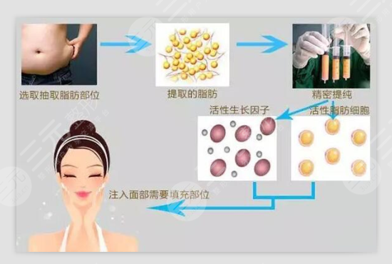 眼窝凹陷怎么办