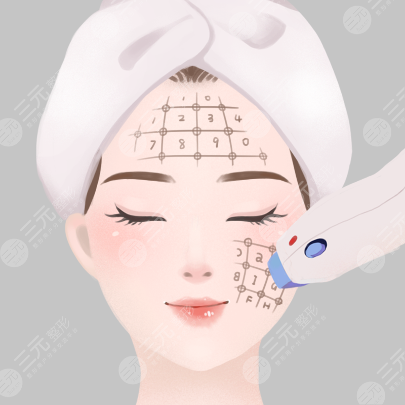 面部轮廓提升