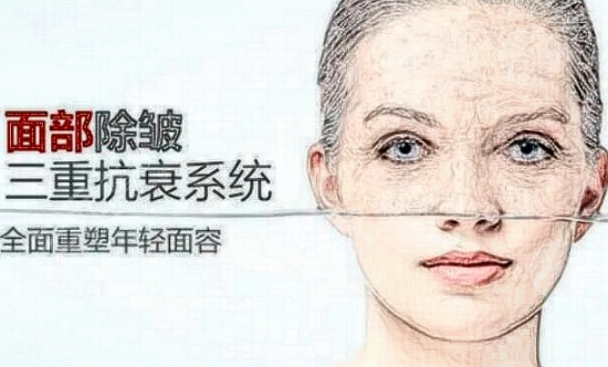 面部除皱术多少钱