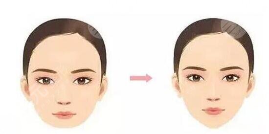 垫下巴价格是多少?价格收费详情