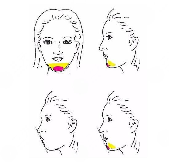 垫下巴价格是多少?