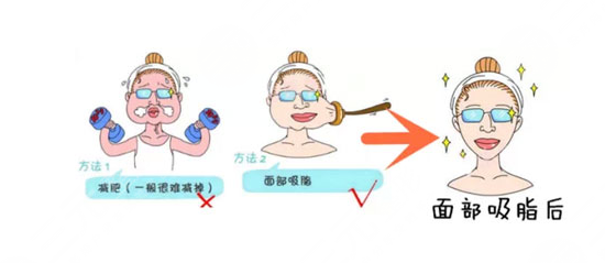 面部吸脂果?
