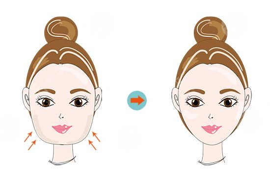 面部光纤溶脂的副作用有哪些?