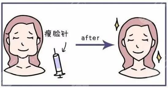 打针瘦脸和抽脂瘦脸哪个好？来看看你适合哪一种！
