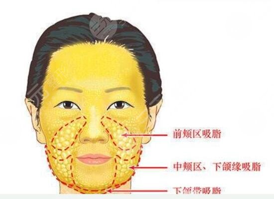 圆脸怎么变瓜子脸