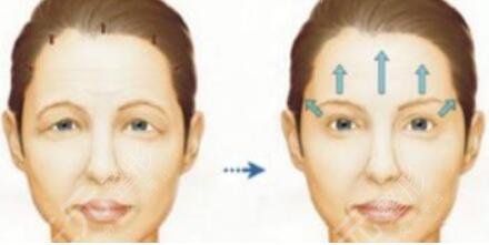 赛诺龙5gmax极速提拉和欧洲之星注意事项