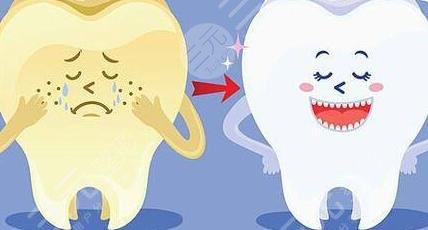 深圳正夫口腔牙齿贴面分享