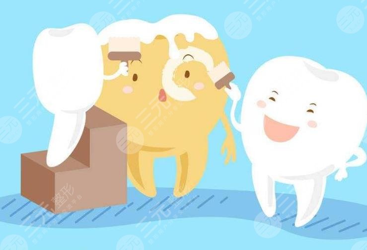 深圳正夫口腔牙齿贴面分享