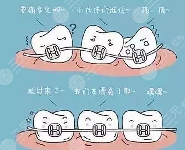 牙齿矫正缓解项目相关科普