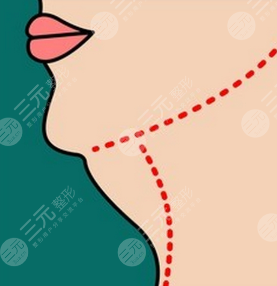 如何减去双下巴