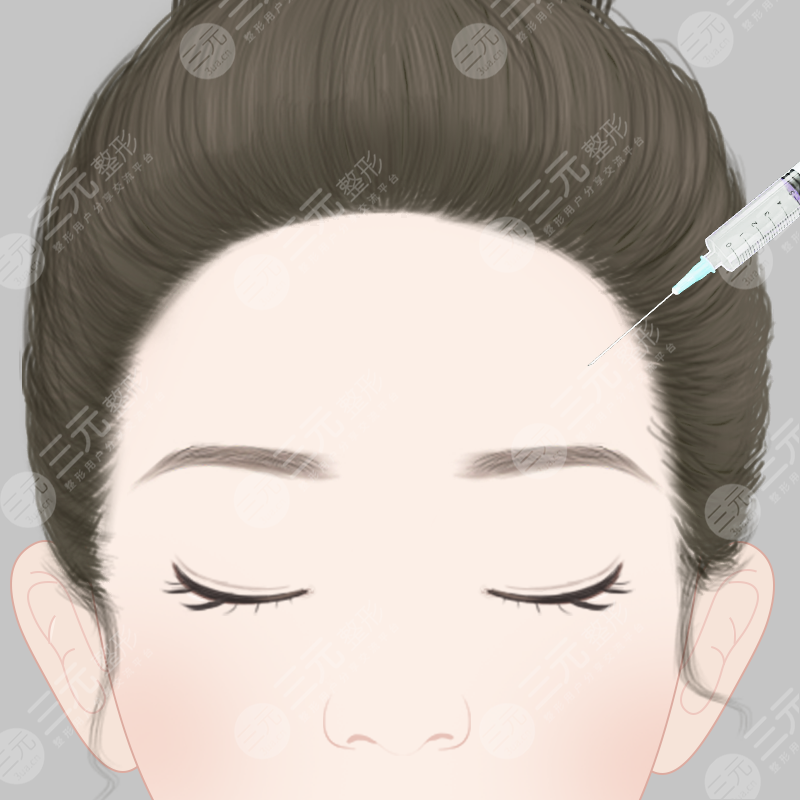 抬头纹除皱的注意事项