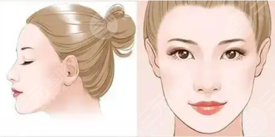 下颌线提升能够维持多久