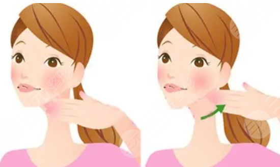 术后的护理工作