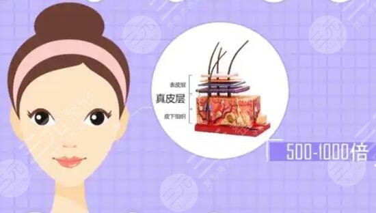 自己可以注射玻尿酸吗 为什么不能自己注射玻尿酸