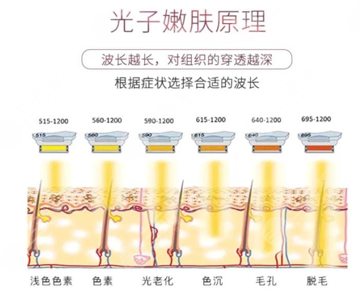 光子嫩肤