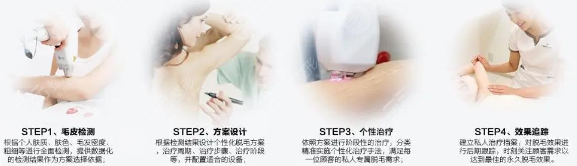 腋下激光脱毛