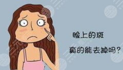 点阵激光后恢复过程图分享,轻松美肌,一键磨皮美白! 点阵激光后恢复过程图分享,轻松美肌,一键磨皮美白!
