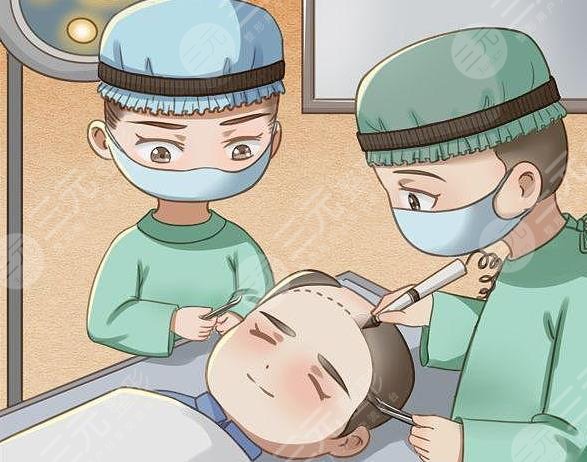 植发手术