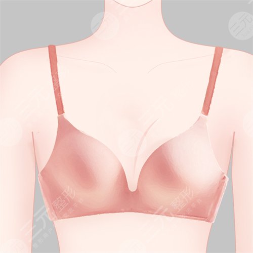 乳晕漂红价格是多少？乳晕漂红价格解密！