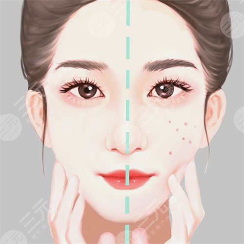 M22光子嫩肤一般多少钱?有这几个副作用!避坑知识点|千万别交“智商税”!