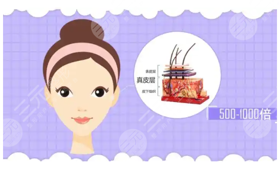 玻尿酸,注射,吸收