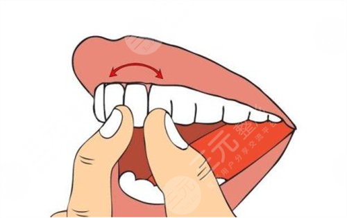 烤瓷牙的寿命跟什么有关?