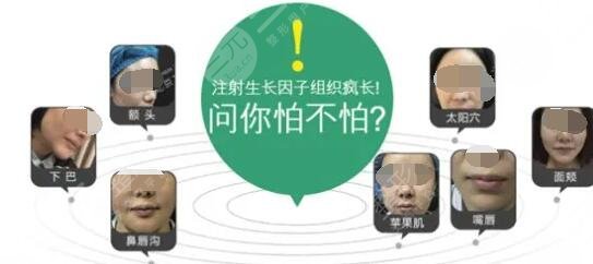 取出来后还会再长么?的危害副作用!看完觉得心惊胆战!