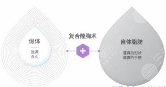 复合隆胸可以维持多久？术后这5件事做好，美波伴你到老！