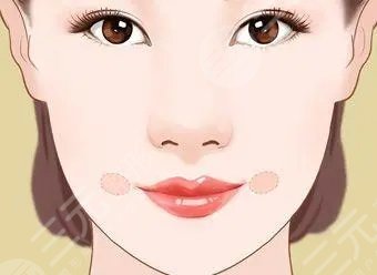 人造酒窝价格多久恢复