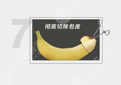 <b>包皮修复的手术方式</b>