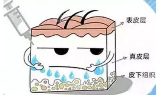 打水光补水会有后遗症吗 打水光补水会有后遗症吗