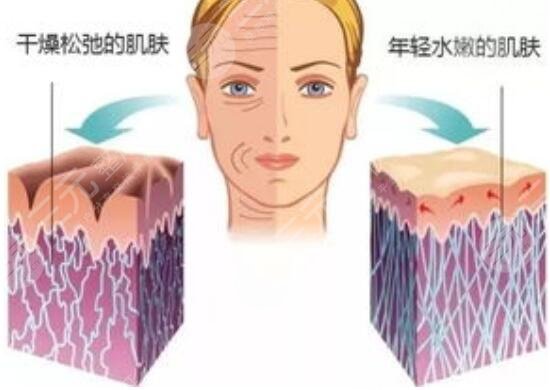 皮肤干燥,打水光补水,有用吗