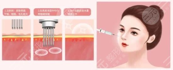 水光补水