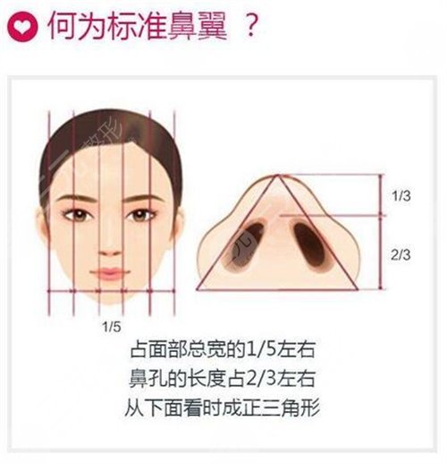 鼻翼缩小手术怎样恢复较好 鼻翼缩小手术怎样恢复较好