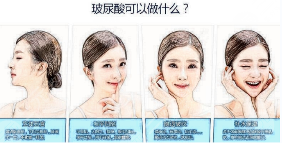 艾莉薇玻尿酸