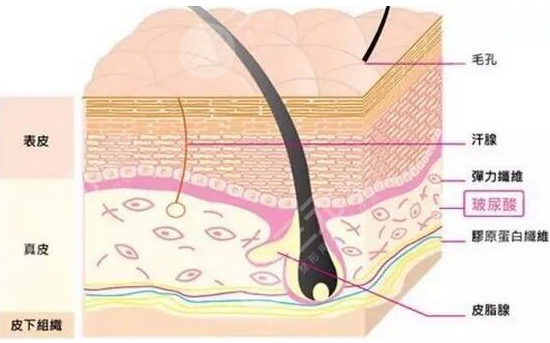 美白祛斑和玻尿酸填充哪个好？2者应该怎么选？注意事项有哪些呢？