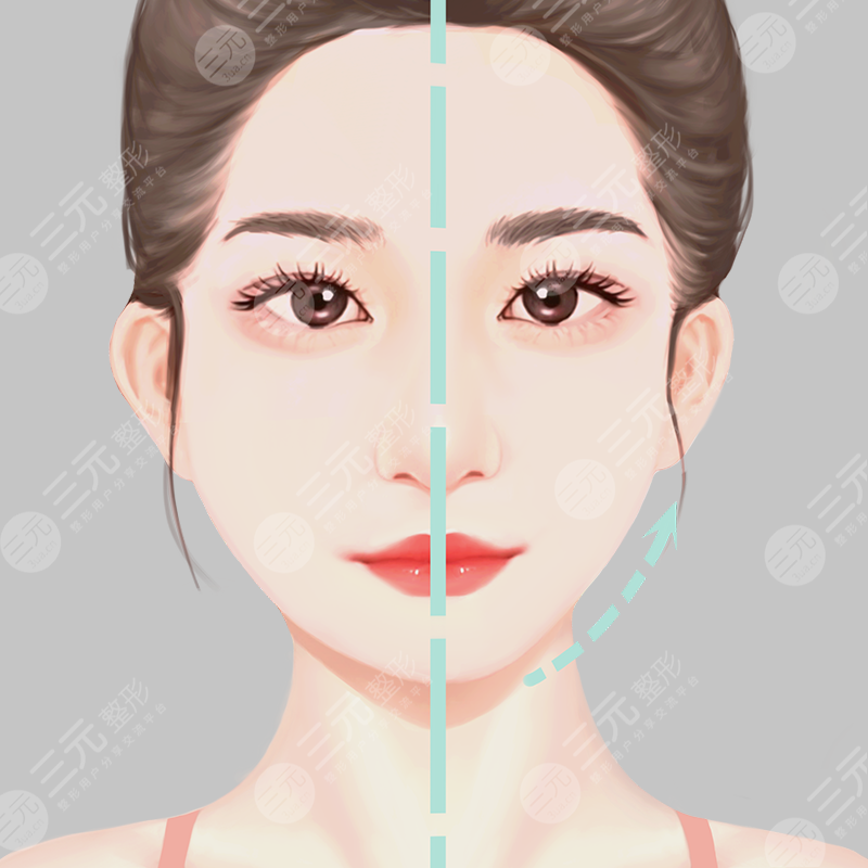 微针美容价格影响因素