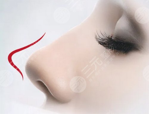 隆鼻,手术后,到底,能不能,做猪鼻子