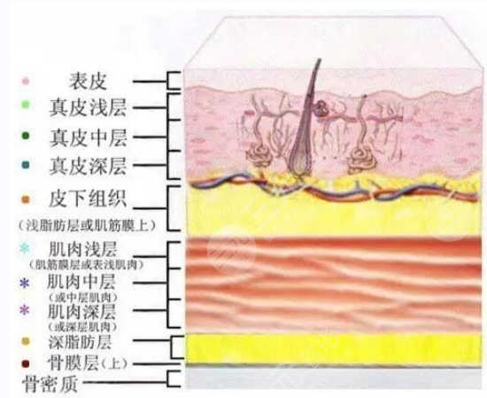 注射玻尿酸对身体有害吗 注射玻尿酸会打到血管吗 注射玻尿酸对身体有害吗 注射玻尿酸会打到血管吗