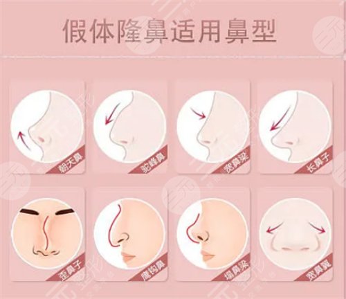 如何能让自己的鼻子变高变挺 鼻子整形手术会有什么后遗症 鼻子整形手术的后遗症有哪些是什么