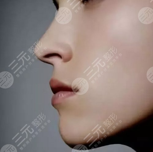 鼻翼缺损手术以后的注意事项