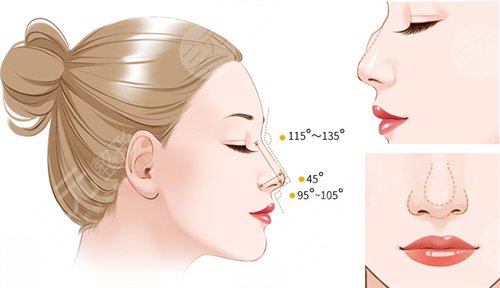 做歪鼻矫正手术的果，让你的鼻子“改邪归正”