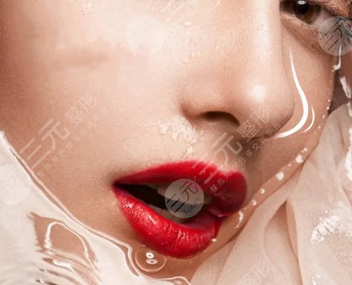 鼻子整形手术后的注意事项