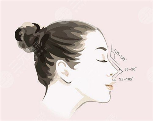 朝天鼻整形手术原理