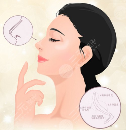 朝天鼻手术多少钱?