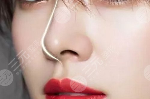 朝天鼻手术多少钱?