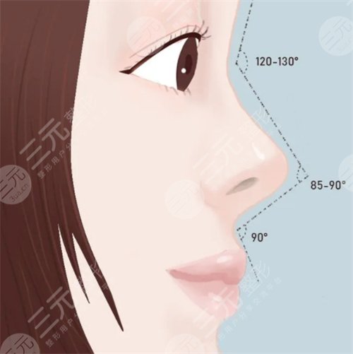 朝天鼻术后注意事项