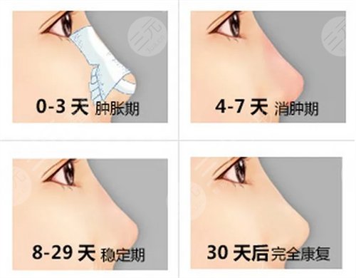 手术之前