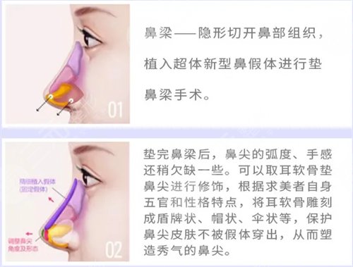 手术之后的一个月